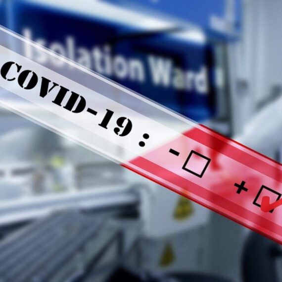 teste të shpejta që detektojnë Antigjenin e SARS COV-2