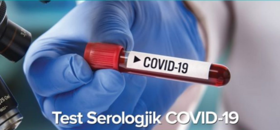 Testi Serologjik ndaj Covid-19
